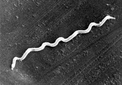 An electron micrograph of the bacteria treponema, which causes syphilis