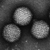 A type of adenovirus that causes pool fever | The National Institute of Infectious Diseases / via Kyodo
