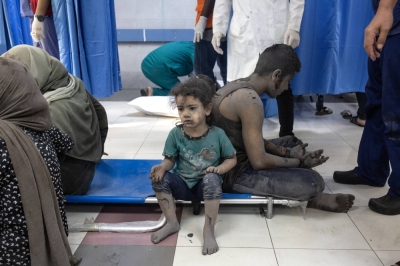 Injured children at Shifa hospital in Gaza City on Oct. 12 following Israeli air strikes