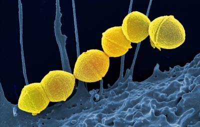 A scanning electron micrograph of group A streptococcus bacteria