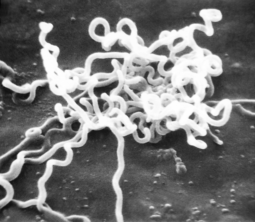 Electron micrograph of Treponema pallidum, the causative agent of syphilis