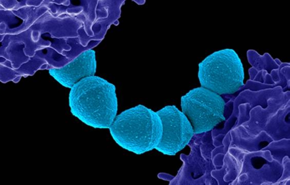 A colorized scanning electron micrograph of group A streptococcus bacteria 