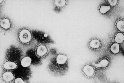 A microscopic view of the SARS-CoV-2 virus particles. 