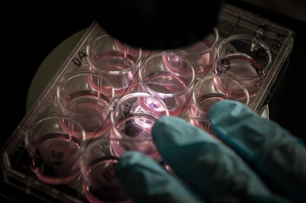 Automated iPS cell production to start in Japan in April Automated iPS cell production to start in Japan in April